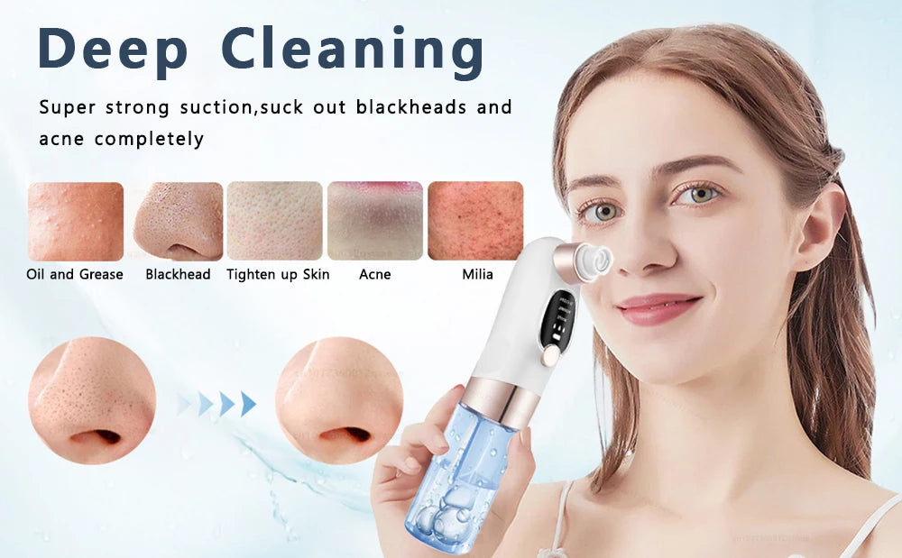 Blackhead Removal