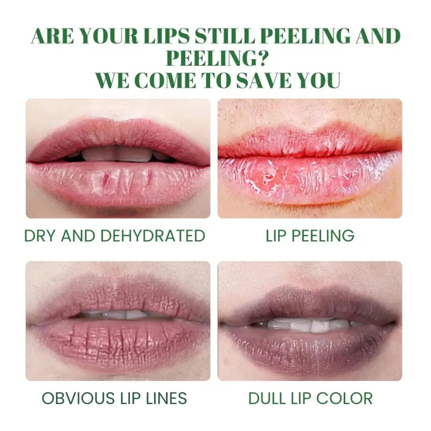 Turmeric Lip Balm – Dark Lip Lightening & Deep Moisturizing Care