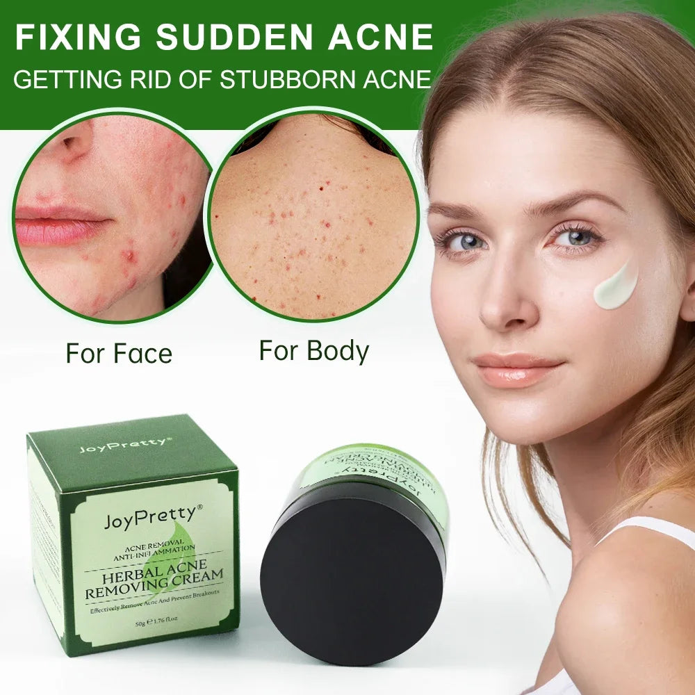 ClearGlow Herbal Acne Cream