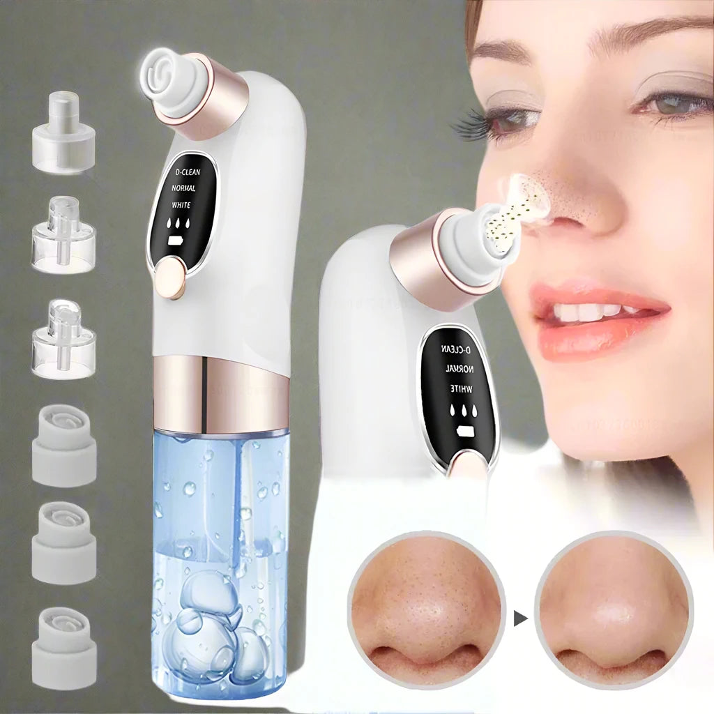 Blackhead Removal