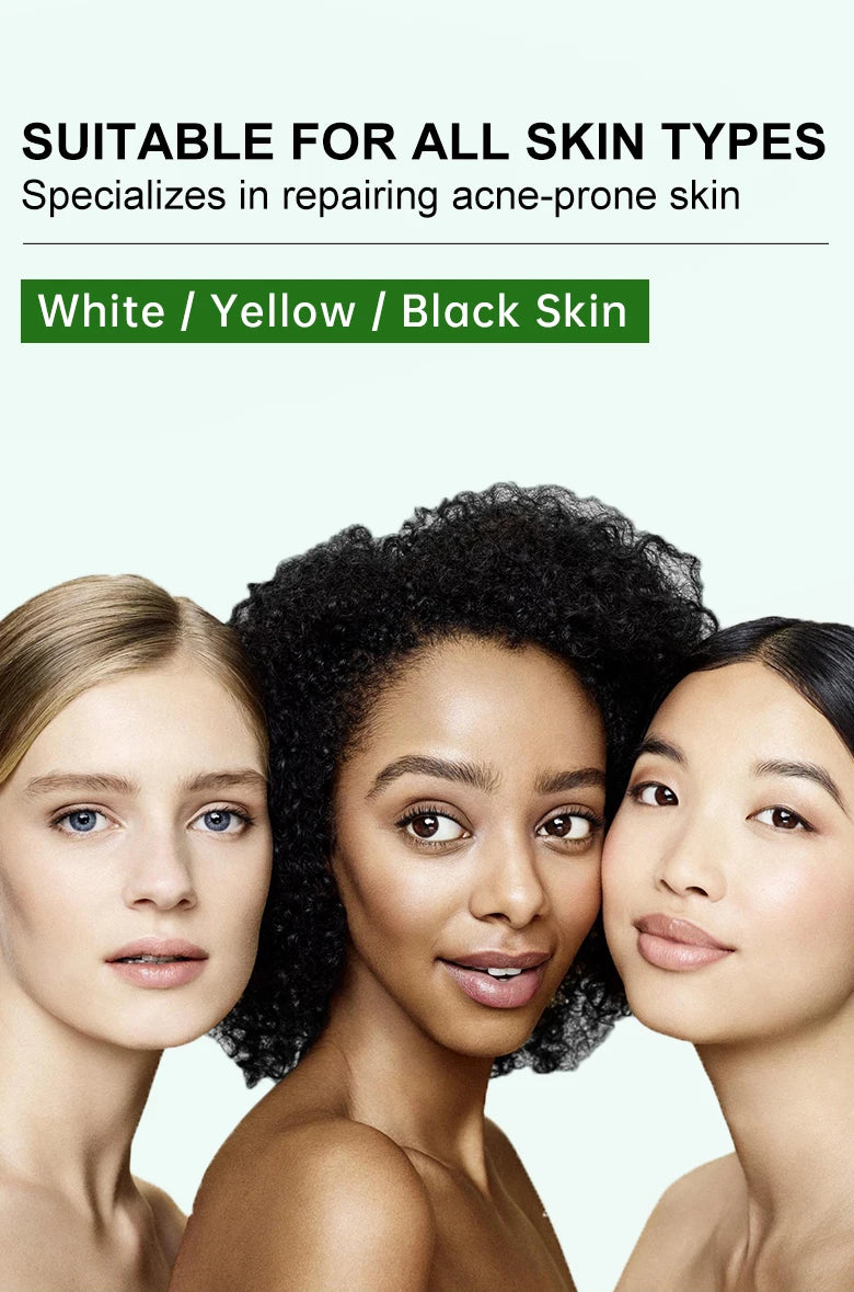 ClearGlow Herbal Acne Cream