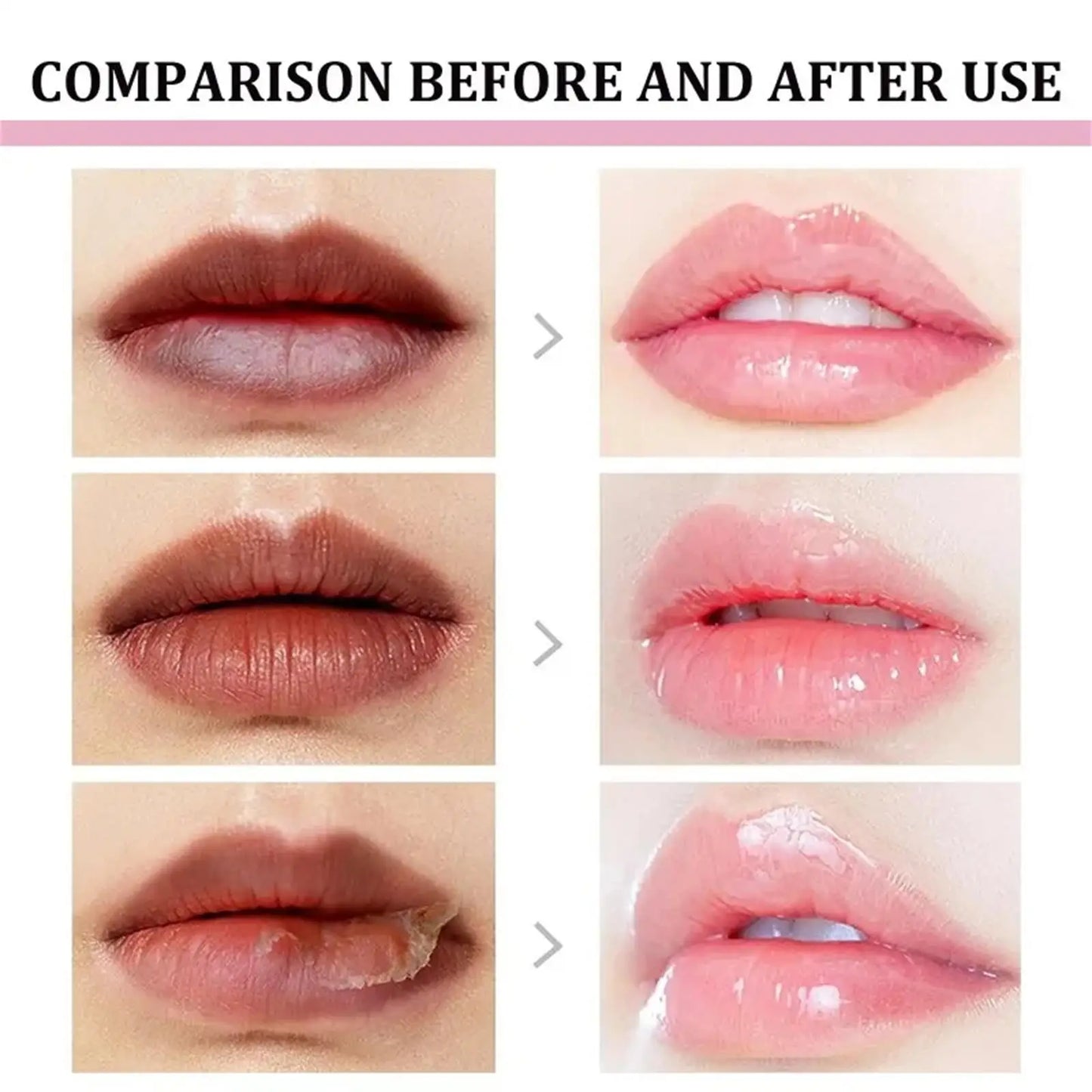 Turmeric Lip Balm – Dark Lip Lightening & Deep Moisturizing Care