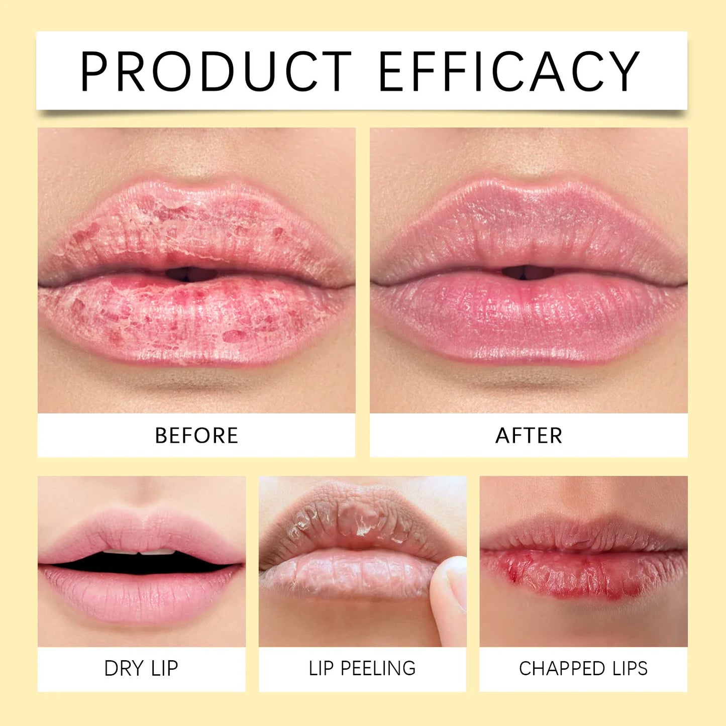 Turmeric Lip Balm – Dark Lip Lightening & Deep Moisturizing Care