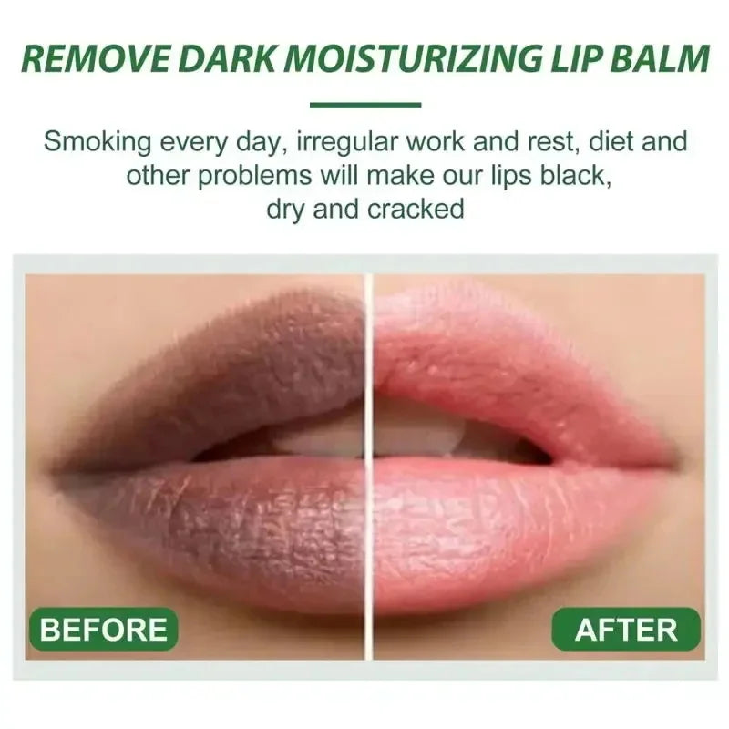 Turmeric Lip Balm – Dark Lip Lightening & Deep Moisturizing Care