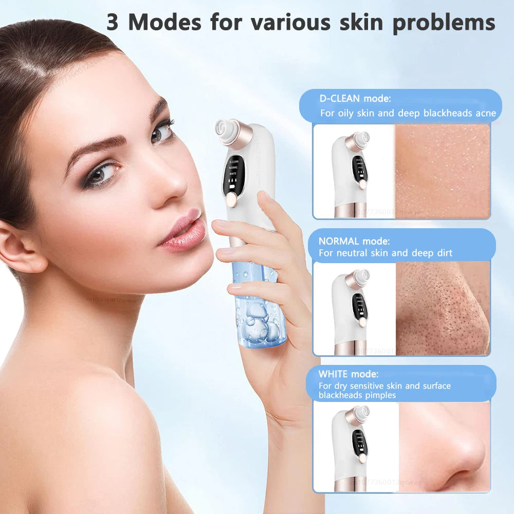 Blackhead Removal