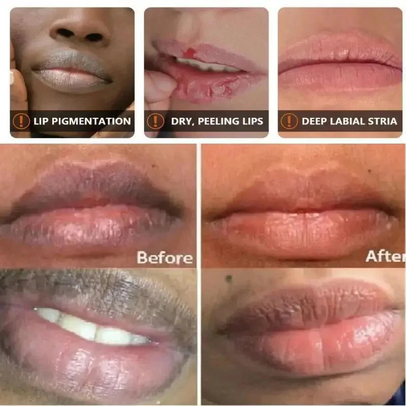 Turmeric Lip Balm – Dark Lip Lightening & Deep Moisturizing Care