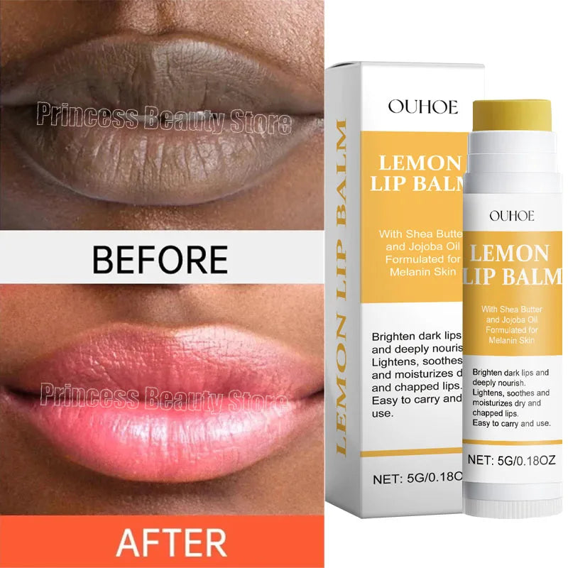 Turmeric Lip Balm – Dark Lip Lightening & Deep Moisturizing Care