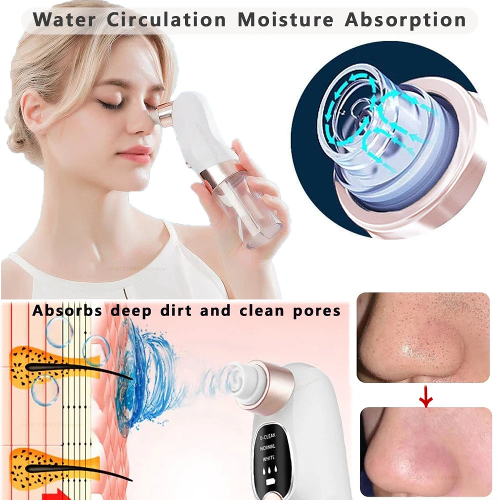 Blackhead Removal