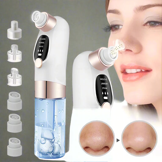 Blackhead Removal